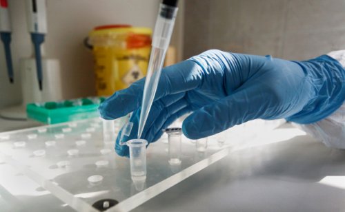 В одесской инфекционке использовали первые 30 тестов на коронавирус: все результаты отрицательные