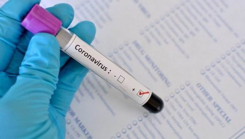 В Украине будут тестировать на коронавирус всех больных с пневмонией