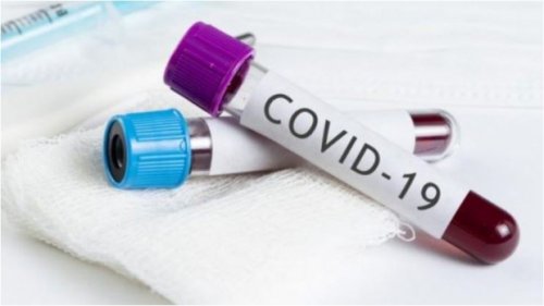 В одесскую больницу доставили первого заболевшего COVID-19 из «базы обсервации»