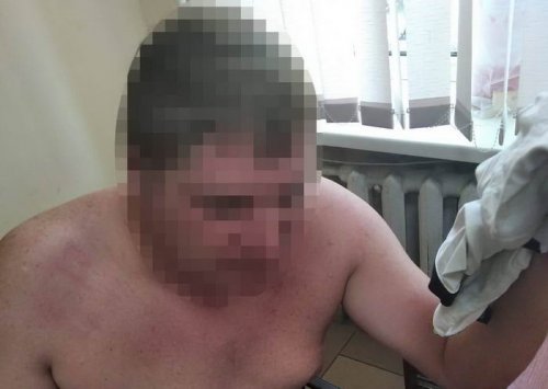 Пьяный водитель под Одессой напал на полицейских