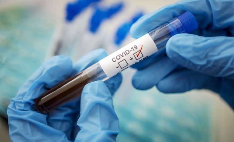В Рени ухудшается ситуация с распространением коронавируса