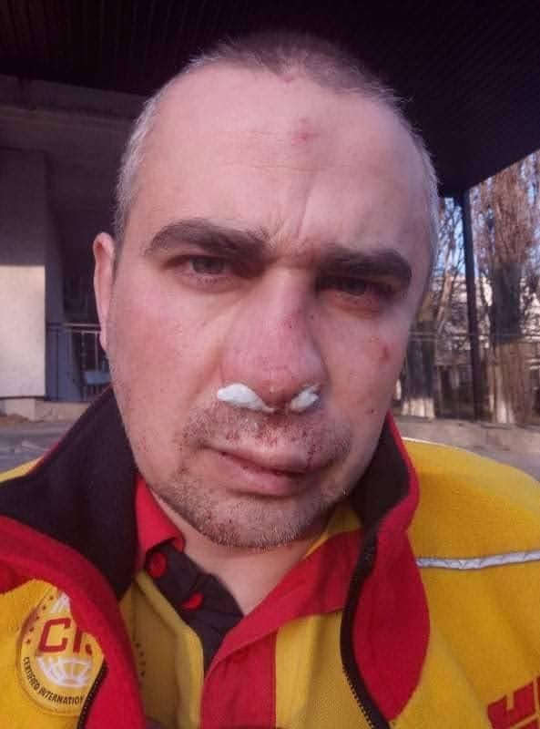 В Одессе сотрудники охранной фирмы сломали нос и челюсть ветерану АТО за парковку