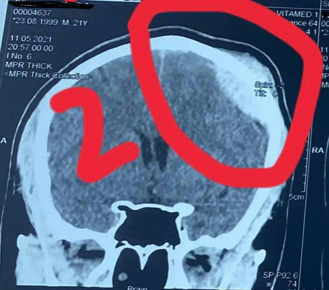 Одессит на электросамокате получил перелом черепа (видео)