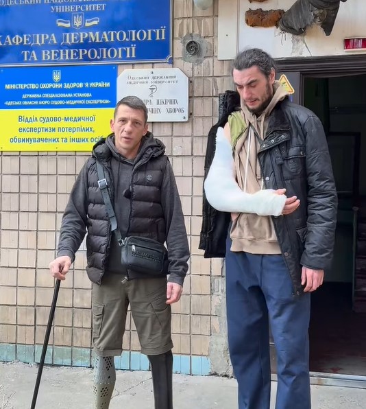Ветеран війни повідомив, що в Одесі співробітники ТЦК зламали йому руку
